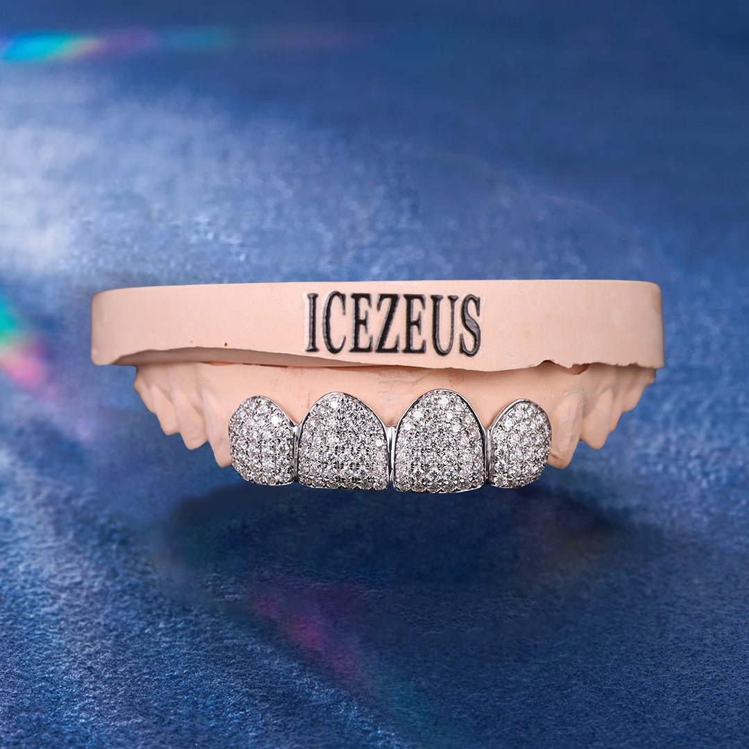 Close-up of iced moissanite grillz with flawless clarity and sparkle