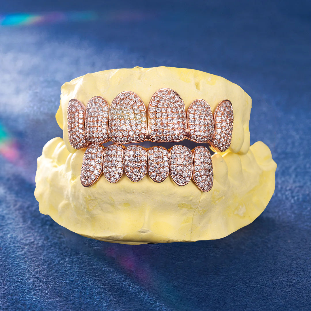 Celebrity-style moissanite grillz for streetwear fashion