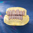 Celebrity-style moissanite grillz for streetwear fashion