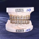 Custom Grillz for Black Men