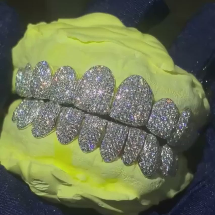 925 Sterling Silver Grillz – Custom Iced-Out VVS Moissanite Hip
